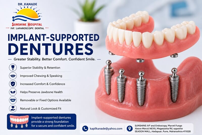 Implant-Supported Dentures in Pune